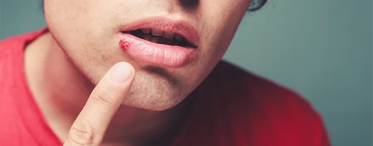 Alívio da dor orofacial